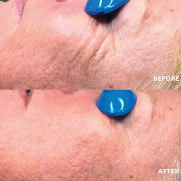 Hydropeptide Nimni Cream | NEW SKINCARE - Picture 3 of 3